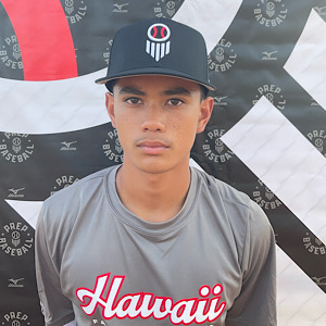 Brock Ayudan