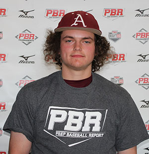 Carson Agan