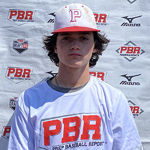 Charlie Severino