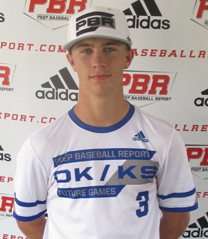 Chase Burgess