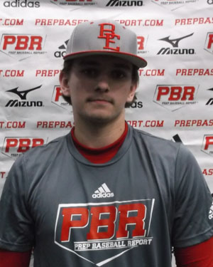 Brock Hammond