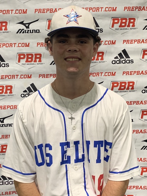 Mason Deletis