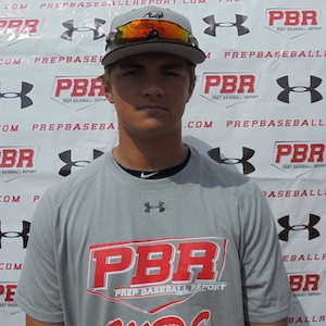 Brett Upton