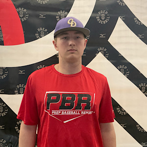 Brady Stoeklen