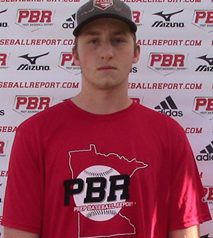 Matthew Beek Kitzman