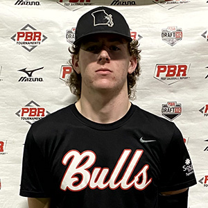 Dalton Forck