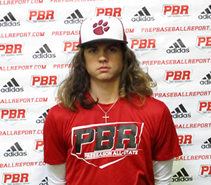 Rhett Lowder