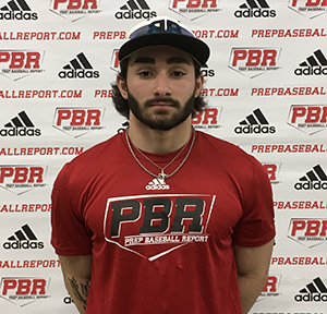 Nick Calabrese