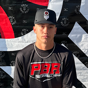 Braxton Prosser