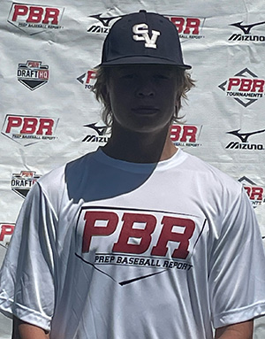 Brock Bracher