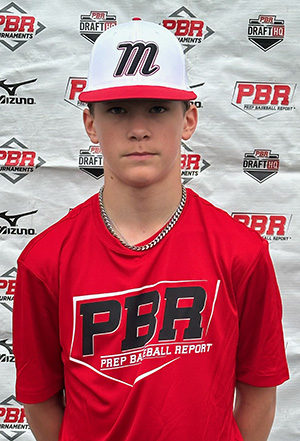 Braden Durrett